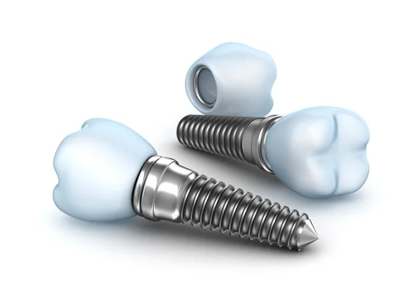 Implantes dentários, coroa com pino isolado em branco Imagens Royalty-Free