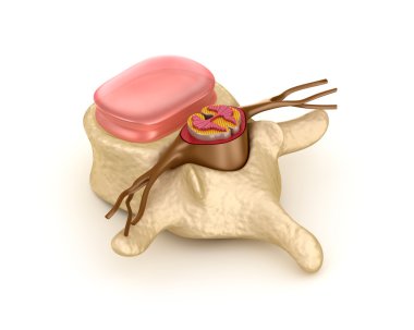 Spinal segment disk ile