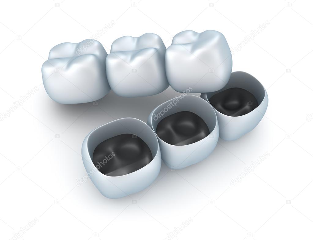 Artificial tooth crowns.