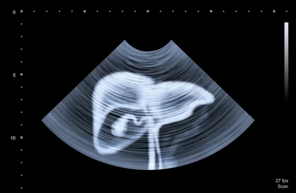 Ultraschalluntersuchung der menschlichen Leber — Stockfoto