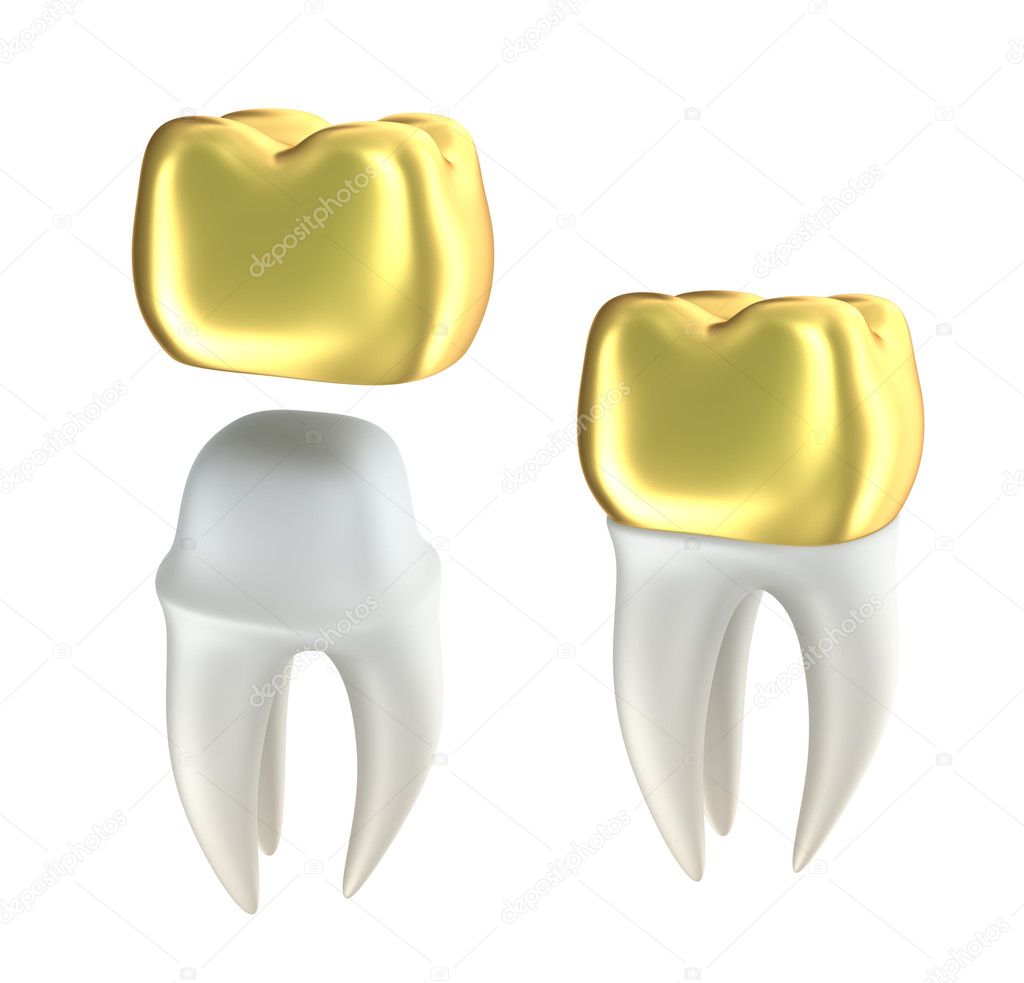 Golden Dental crowns and tooth, isolated on white