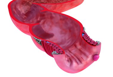 hemoroid: anal hastalıklar