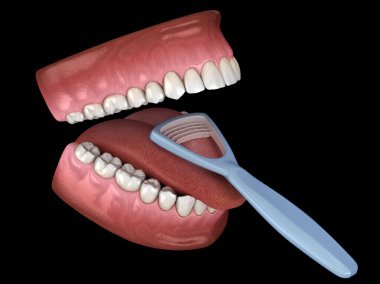 Dil temizliği - Kazıyıcı. Ağız hijyeni tıbbi olarak doğru 3d illüstrasyon.