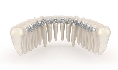 Dişler ve temiz diş telleri. 3B illüstrasyon kavramı