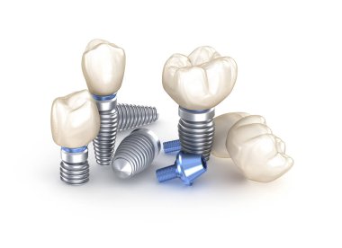Diş implantları. İnsan dişlerinin 3 boyutlu illüstrasyon kavramı