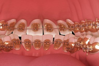 Dil telleri sistemi. Altın diş tellerinin 3D illüstrasyon konsepti