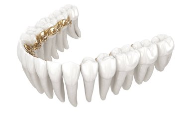 Dil telleri sistemi. Altın diş tellerinin 3D illüstrasyon konsepti