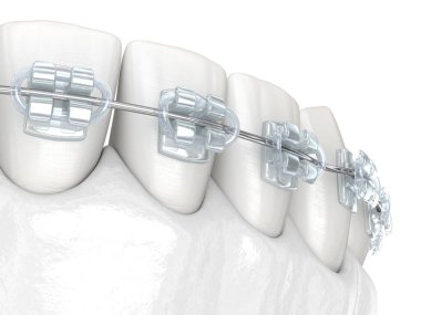 Dişler ve temiz diş telleri. Tıbbi olarak doğru olan 3 boyutlu diş illüstrasyonu