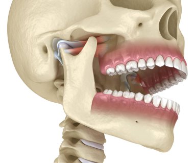 TMJ: Temporoçene eklemleri. Sağlıklı tıkanma anatomisi. İnsan dişleri ve protez kavramının tıbben doğru üç boyutlu çizimi