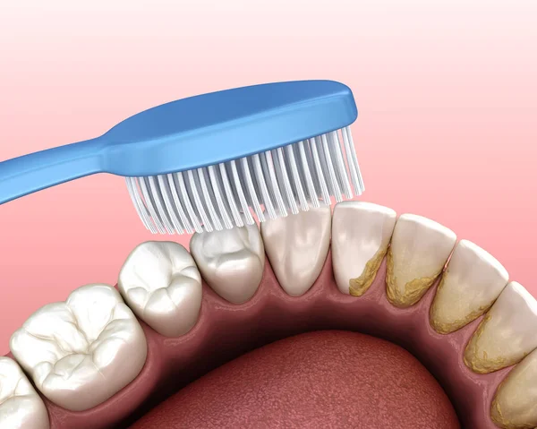 Diş Fırçası Diş Temizliği Ağız Hijyeninin Tıbbi Açıdan Doğru Boyutlu — Stok fotoğraf