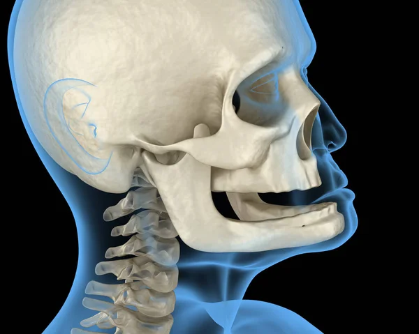 Onderkaak Botrecessie Het Verliezen Van Tanden Medisch Nauwkeurige Tandheelkundige Illustratie — Stockfoto