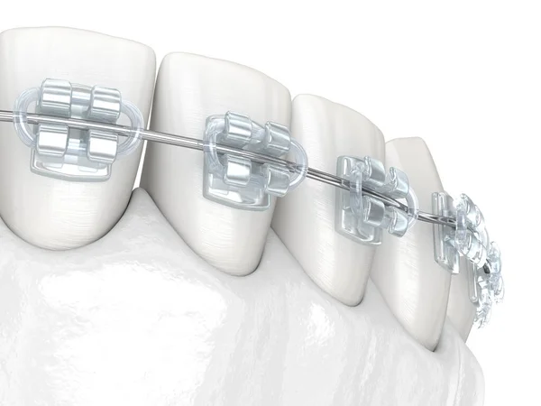 Tänder Och Tandställning Medicinskt Korrekt Dentala Illustration — Stockfoto