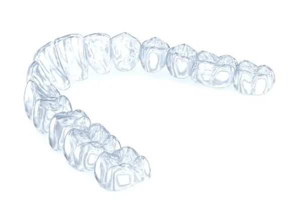 异形支撑或看不见的固位体 医学上准确的牙科3D图像 — 图库照片