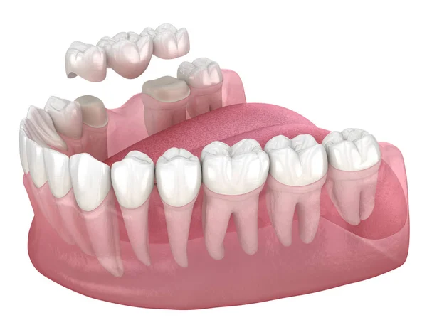 Tandheelkundige Brug Van Tanden Molair Premolair Medisch Nauwkeurige Illustratie Van — Stockfoto