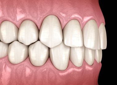 Normal tıkanıklığı olan sağlıklı insan dişleri. Tıbbi olarak doğru diş 3D illüstrasyon