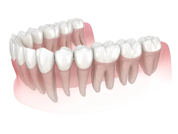 Morfologia Ludzkich Zębów Medycznie Dokładna Ilustracja Zęba — Zdjęcie stockowe