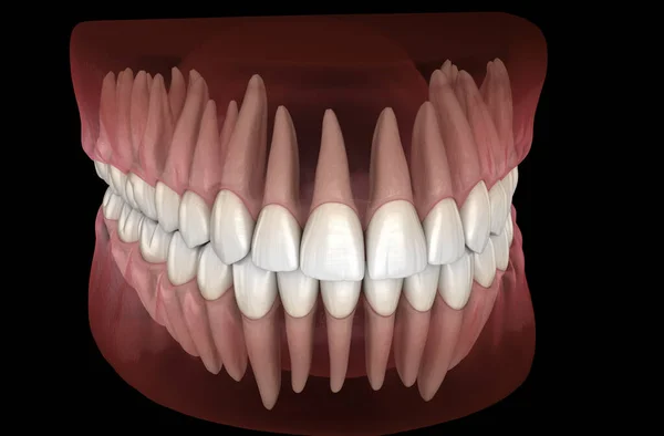 Morfologia Dos Dentes Humanos Ilustração Dente Medicamente Precisa — Fotografia de Stock