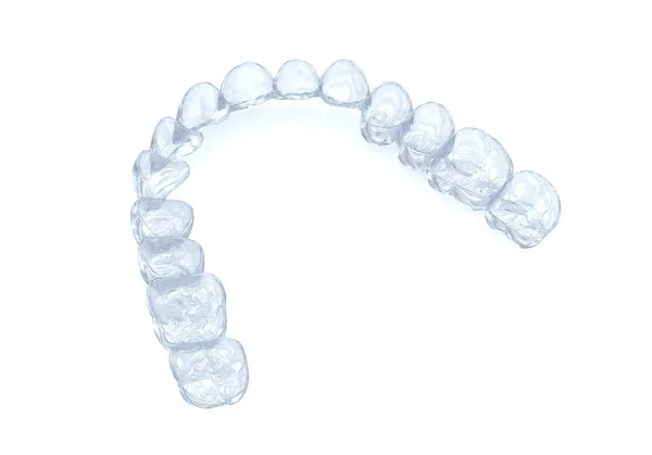 白にブレースや目に見えない家臣を配置します 医学的に正確な歯科3Dイラスト — ストック写真