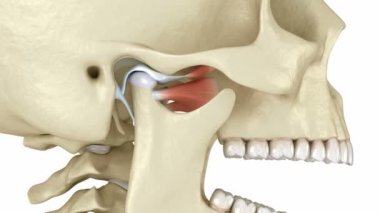 Temporomandibular eklemler ve çıkık eklem diski. Tıbbi olarak doğru 3B canlandırma