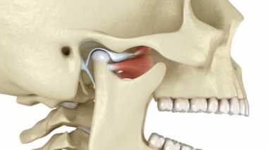 Temporomandibular eklemler ve çıkık eklem diski. Tıbbi olarak doğru 3B canlandırma