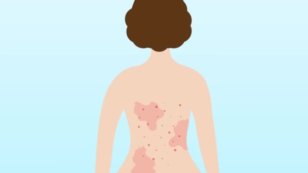 Женщины снова в прыщах и пятнах, дерматологические проблемы, концепция ухода за кожей. — стоковое видео