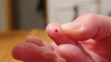 Kapatın. Masada diyabetik ölçümü yapan bir adam var..