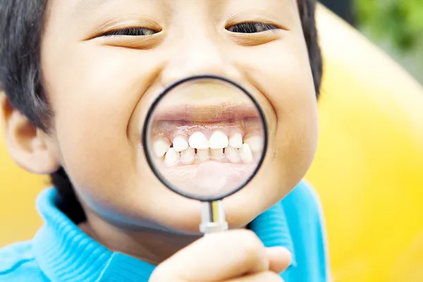 Gesunde Zähne des Kindes — Stockfoto