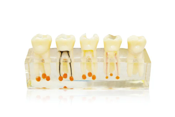 Dentes Close-up — Fotografia de Stock