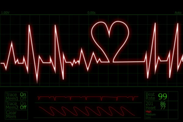 Heart beat pulse — Stock Photo, Image