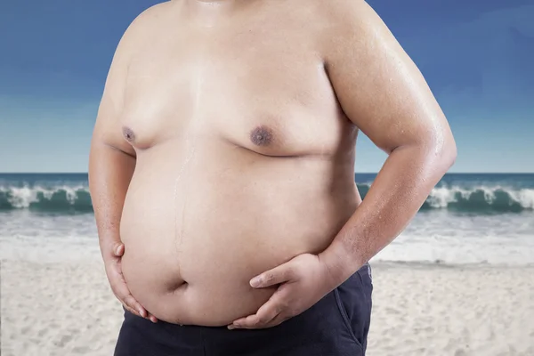 Fat man holding his stomach at beach 1 — Stock Photo, Image