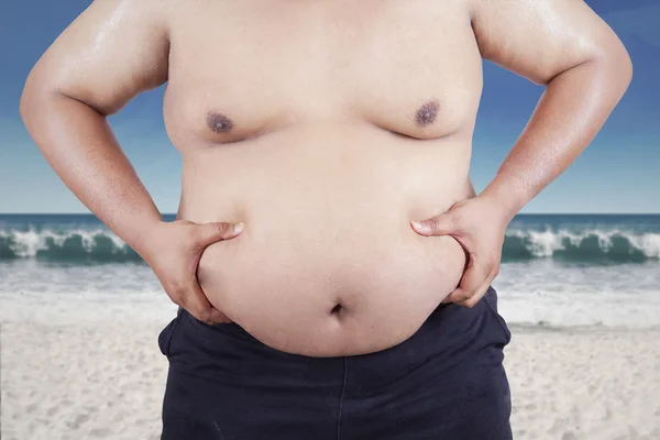 Kövér ember gyomra holding strandon — Stock Fotó