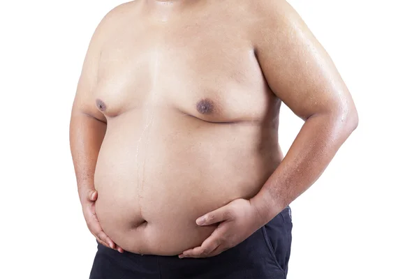 Fat man holding his stomach 1 — Stock Photo, Image