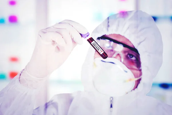 医务工作者穿着危险物品服 同时在实验室保存感染了欧米克隆Covid 19病毒的血液样本 — 图库照片