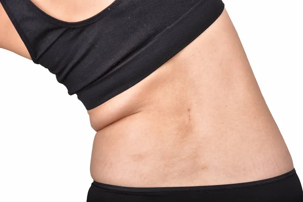 Ryggfett Fett Kvinna Stående Och Visar Magen Fett Övervikt Fetma — Stockfoto