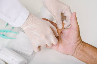 Doktor yaraları sarar, el tedavisi yapar, parmak ağrısı çeker, doktor hastanedeki el yaralanmasını tedavi eder, işaret ve orta parmak dikişleri atar..