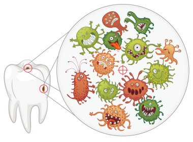 Caries. Funny bacteria and tooth clipart