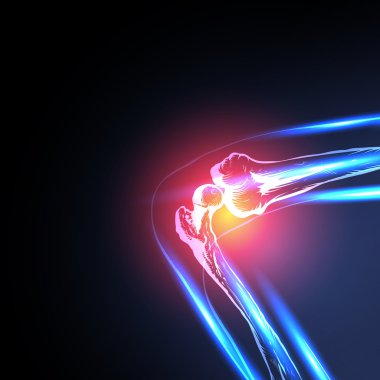 ağrılı diz kolay vektör yakın çekim tüm düzenlenebilir