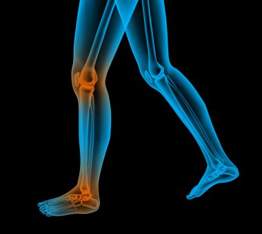 ağrılı ayak render illüstrasyon