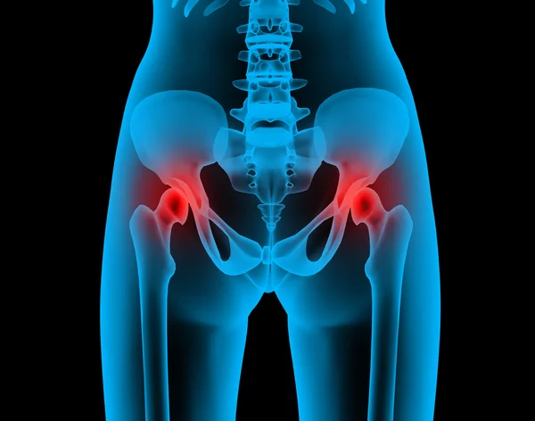 Bóle stawów x-ray człowieka — Zdjęcie stockowe