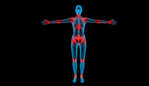 Painful joints x-ray body human — Stock Photo, Image