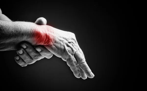 Mãos seniores. Sofrendo de dor e reumatismo — Fotografia de Stock