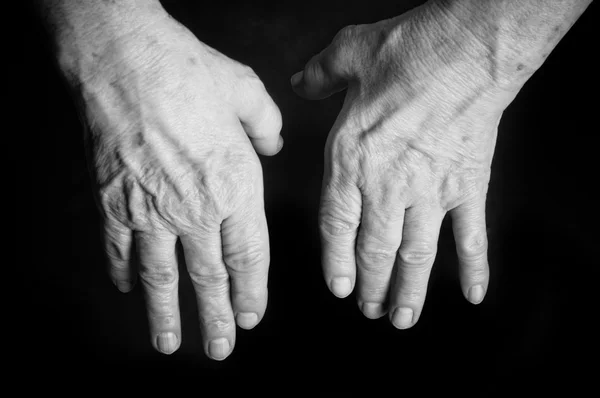 Starszy ręce. cierpiących na ból i reumatyzm — Zdjęcie stockowe