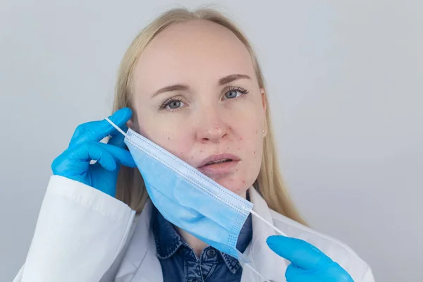 Médico Quita Máscara Protectora Muestra Irritación Piel Cara Medidas Antivirales —  Fotos de Stock