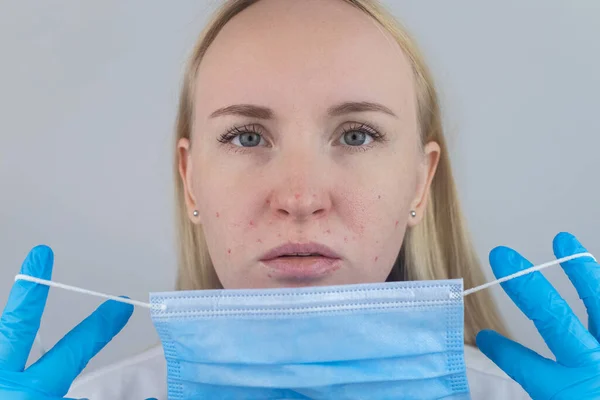 Doctor Removes Protective Mask Shows Irritation Face Skin Antiviral Measures — Stock Photo, Image