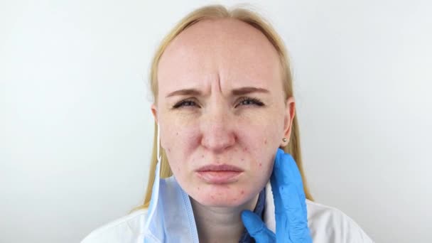 Médico Quita Máscara Protectora Muestra Irritación Piel Cara Medidas Antivirales — Vídeos de Stock
