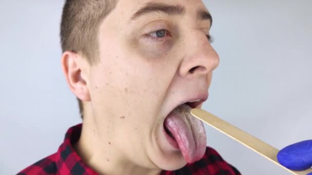 Dilinde Beyaz Kaymak Bir Doktor Gastroenterolog Bir Erkeğin Dilini Inceler — Stok video