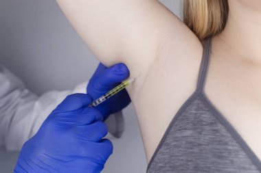 Klinikte hiperhidrozun tedavisi için koltukaltına botulinyum toksin enjekte edilen bir kadın. Artan terleme, anhidroz ya da arızalı bezlerle ilgili sorunların tedavisi. Kozmetoloji