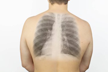 Kavramsal fotoğraf. Arkadan çekilen bir adamın röntgeni. Hastanın sırtında kaburga ve akciğerlerin bir görüntüsü belirdi. Derinin içindeki kemik görüntüsü. Gri arka planda yalnız bir adam..