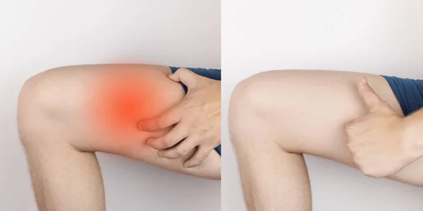 Before and after. On the left, a man has acute pain in the hip after a muscle strain or tear. On the right - the doctors have healed and the muscles of the thigh are no longer disturbed. Bone fracture