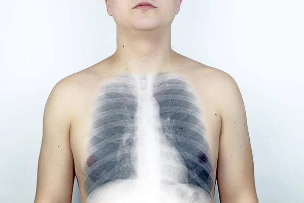 Conceptual Photo Male Chest Ray Image Ribs Lungs Appeared Skin — Stock Photo, Image